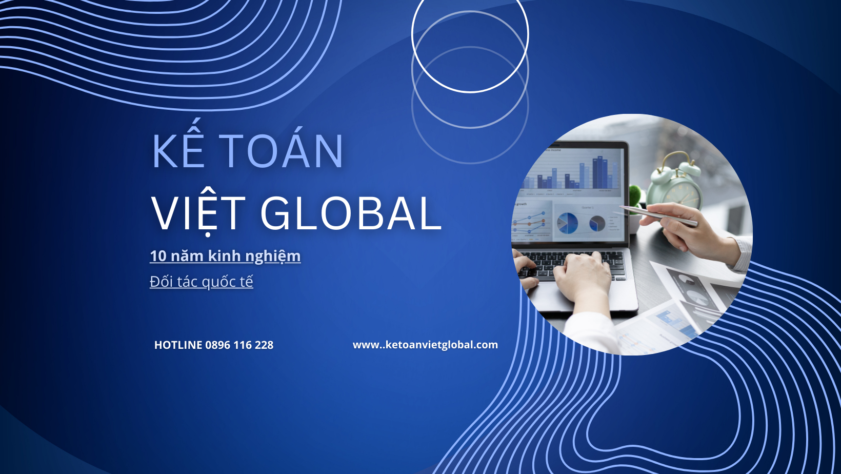 kế toán việt global